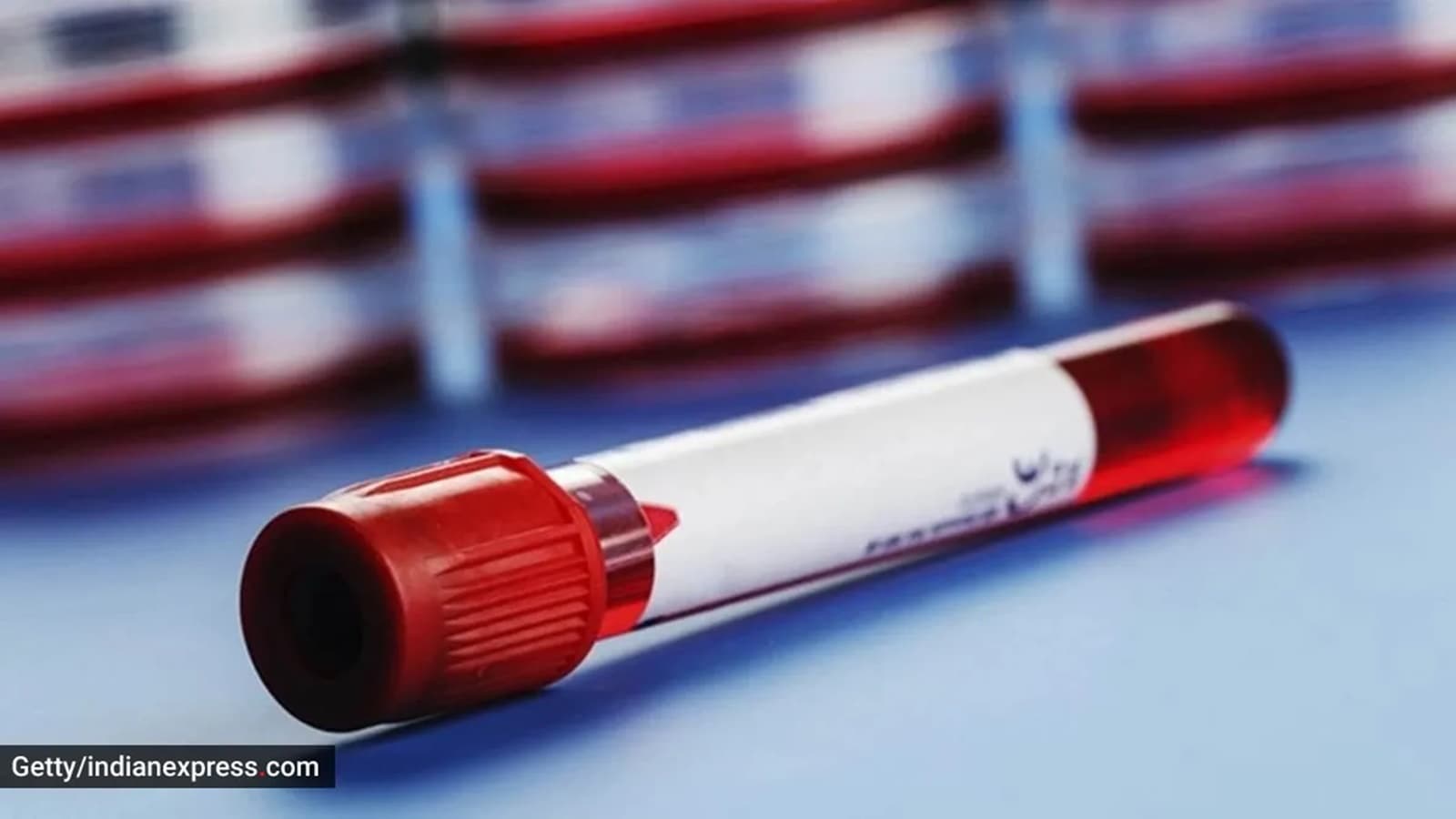 Fasted 13 Hours Instead 8 12 Blood Sugar Test Expert