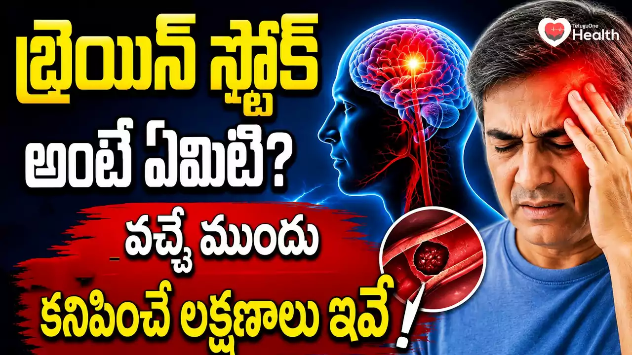 బ్రెయిన్ స్ట్రోక్ వచ్చే ముందు శరీరం ఇచ్చే 5 హెచ్చరికలు.. ఇవి కనిపిస్తే వెంటనే జాగ్రత్త