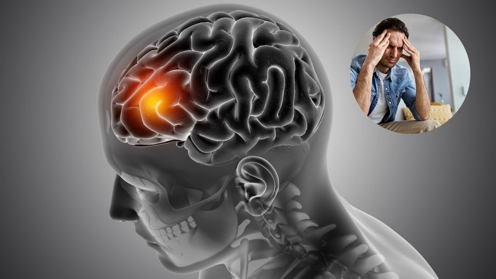 If Your Headache Comes With These Symptoms Dont Ignore It