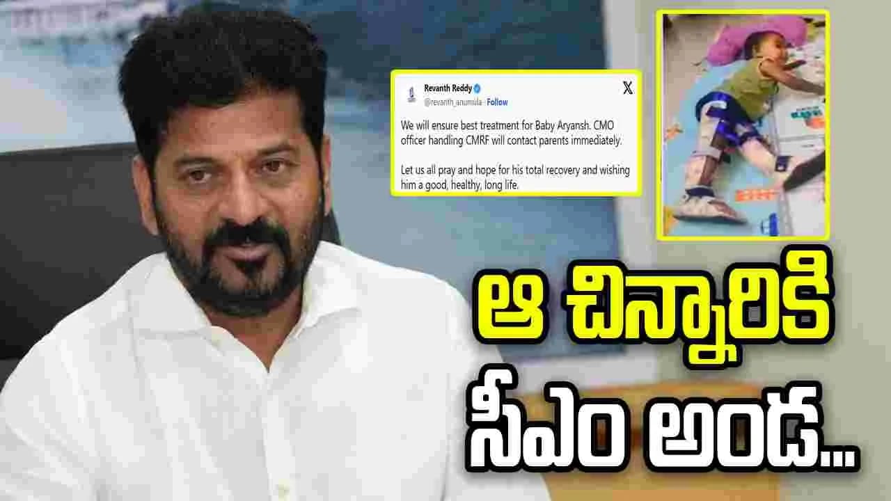 ఉత్తమ వైద్యం అందిస్తాం’.. చిన్నారి ఆర్యాంశ్ కు సీఎం రేవంత్ అండ