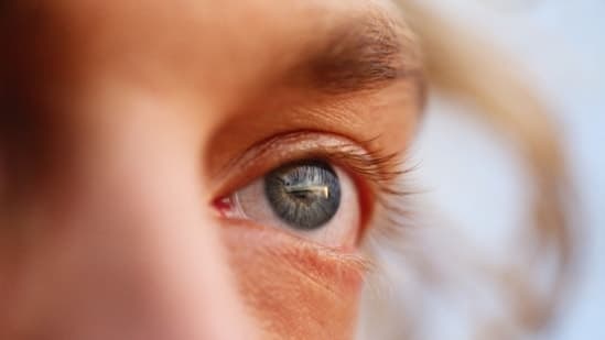 Gurgaon Ophthalmologist Says Watery Eyes Dont Always Mean Healthy Eyes Dry Eye Disease Could Be The Hidden Cause