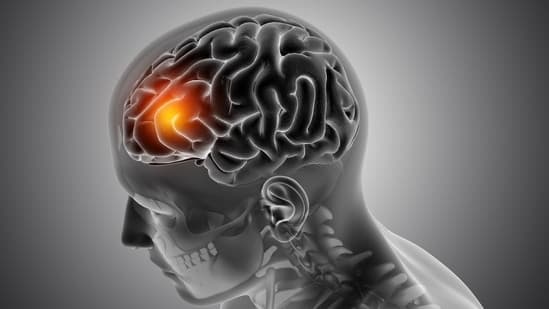 Kolkata Neurosurgeon With Over 36 Years Of Experience Explains Brain Tumour Symptoms Often Misread As Migraine Stress