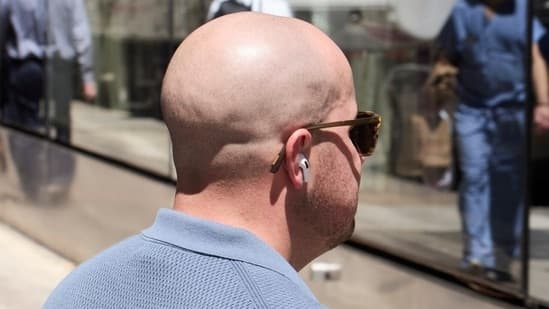 No Hair Transplants Pills Or Toupees Meet The Men Embracing Baldness