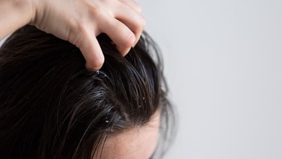 Sweaty And Itchy Scalp This Summer Dermatologist Shares Easy Tips To Keep It Healthy