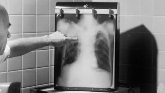 A Much Needed Plan For Tb In India